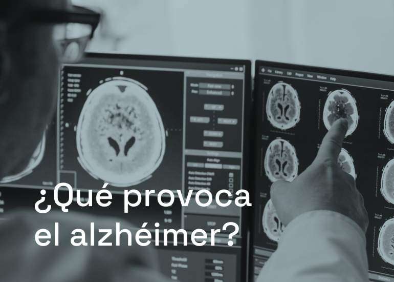 ¿Qué provoca el alzhéimer?